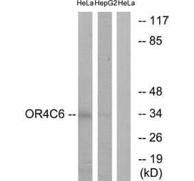 Western Blot - Anti-OR4C6 Antibody (G585) - Antibodies.com
