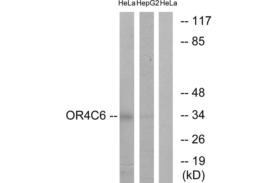 Western Blot - Anti-OR4C6 Antibody (G585) - Antibodies.com