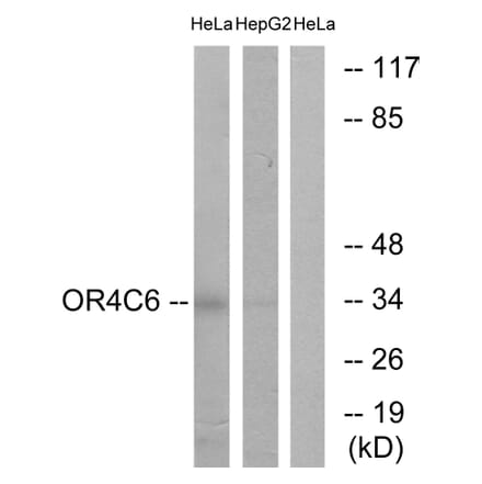 Western Blot - Anti-OR4C6 Antibody (G585) - Antibodies.com
