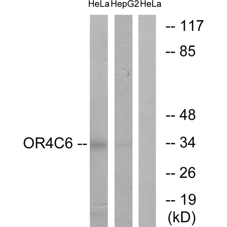 Western Blot - Anti-OR4C6 Antibody (G585) - Antibodies.com