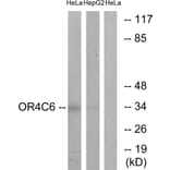 Western Blot - Anti-OR4C6 Antibody (G585) - Antibodies.com
