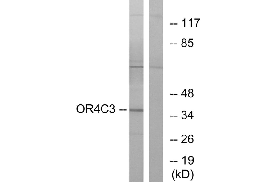 Western Blot - Anti-OR4C3 Antibody (G584) - Antibodies.com