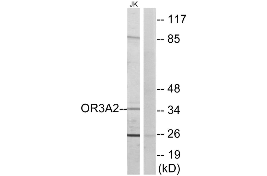 Western Blot - Anti-OR3A2 Antibody (G577) - Antibodies.com