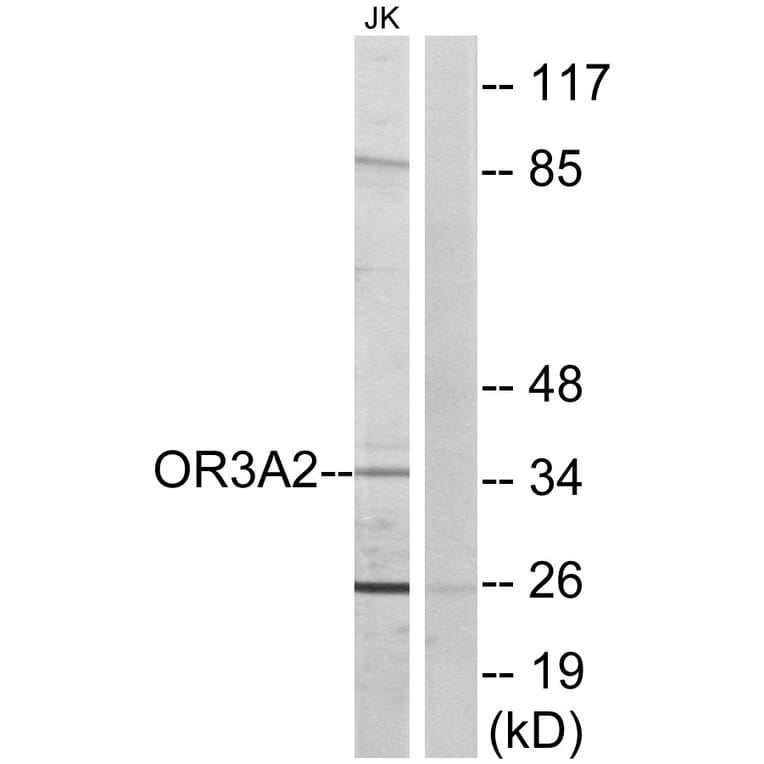 Western Blot - Anti-OR3A2 Antibody (G577) - Antibodies.com