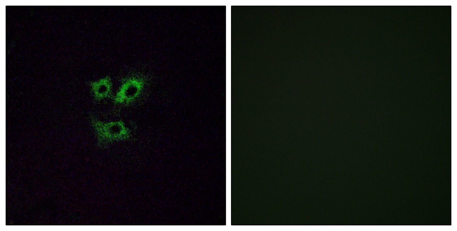 Immunofluorescence analysis of A549 cells using Anti-OR2Y1 Antibody. The right hand panel represents a negative control, where the antibody was pre-incubated with the immunising peptide.