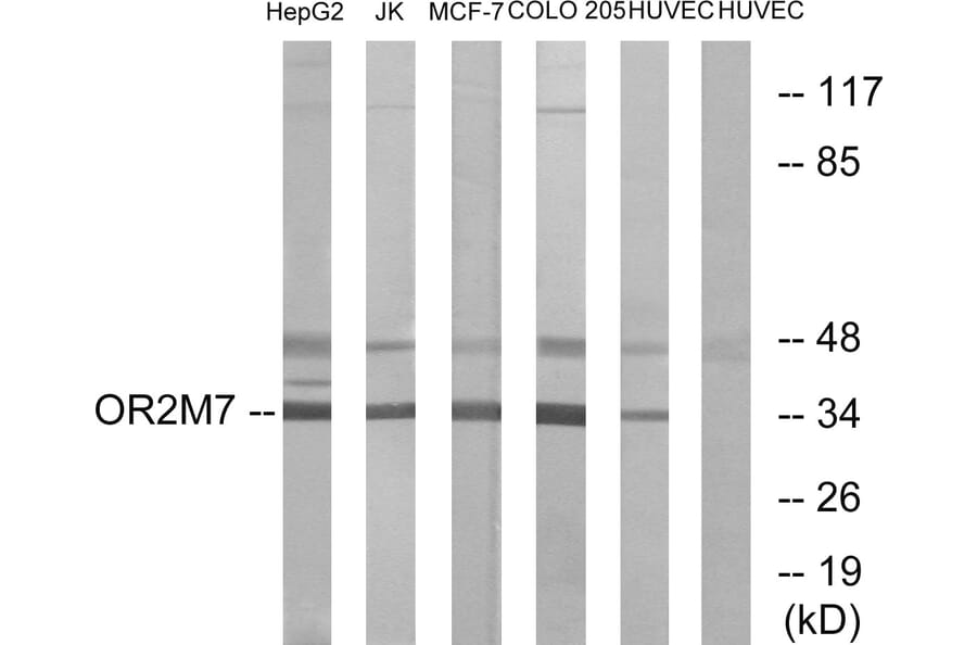 Western Blot - Anti-OR2M7 Antibody (G563) - Antibodies.com