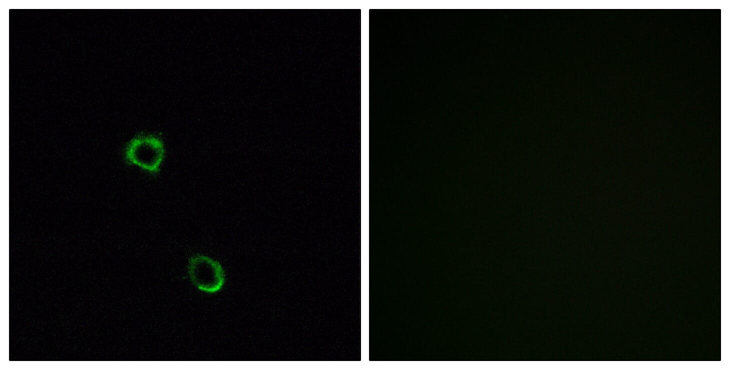 Immunofluorescence analysis of MCF7 cells using Anti-OR2M2 Antibody. The right hand panel represents a negative control, where the antibody was pre-incubated with the immunising peptide.