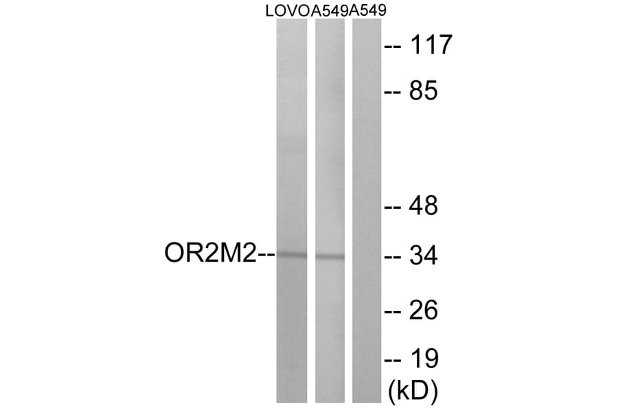 Western Blot - Anti-OR2M2 Antibody (G560) - Antibodies.com