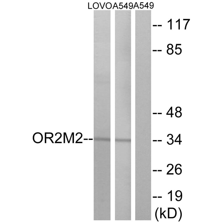 Western Blot - Anti-OR2M2 Antibody (G560) - Antibodies.com