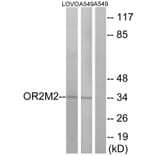 Western Blot - Anti-OR2M2 Antibody (G560) - Antibodies.com