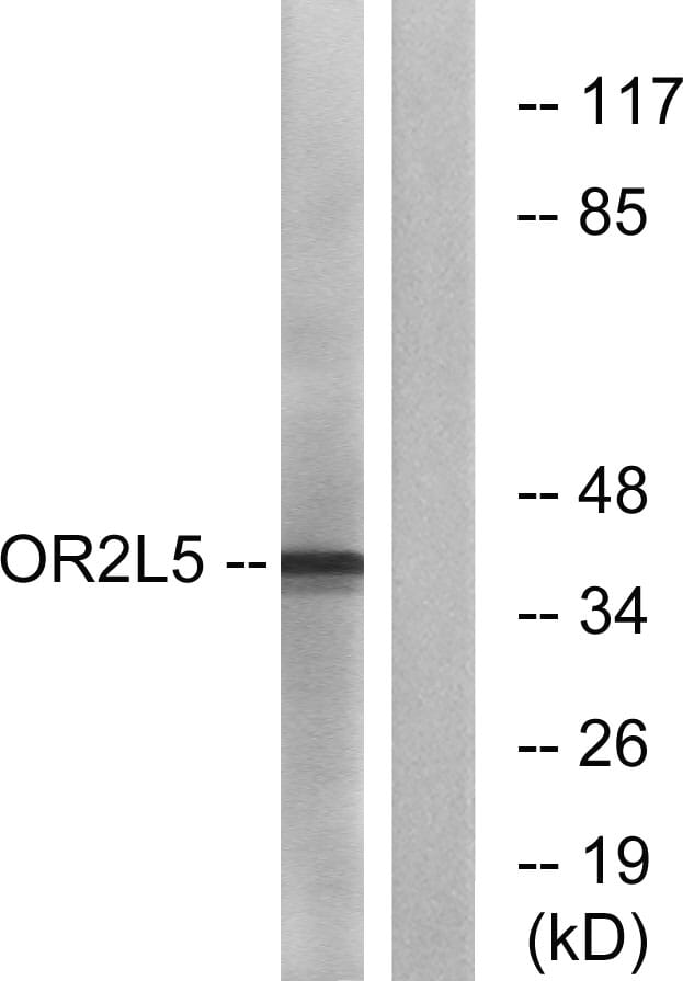 Western blot analysis of lysates from COLO cells using Anti-OR2L5 Antibody. The right hand lane represents a negative control, where the antibody is blocked by the immunising peptide.