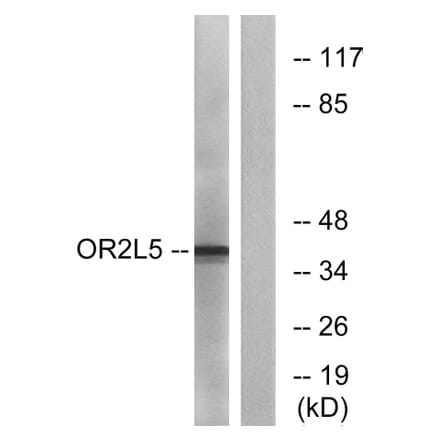 Western Blot - Anti-OR2L5 Antibody (G556) - Antibodies.com