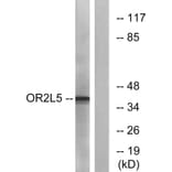 Western Blot - Anti-OR2L5 Antibody (G556) - Antibodies.com