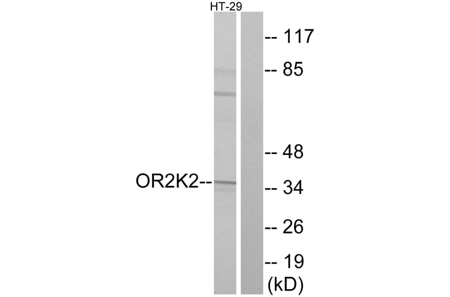 Western Blot - Anti-OR2K2 Antibody (G555) - Antibodies.com