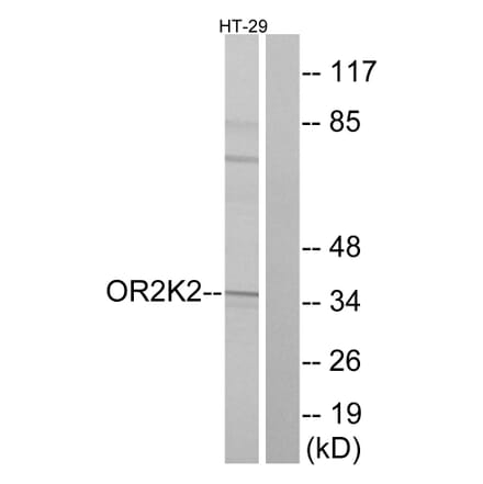 Western Blot - Anti-OR2K2 Antibody (G555) - Antibodies.com