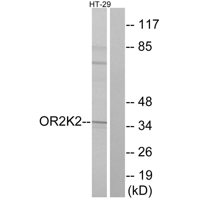 Western Blot - Anti-OR2K2 Antibody (G555) - Antibodies.com