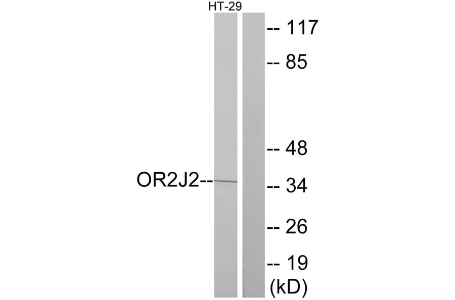 Western Blot - Anti-OR2J2 Antibody (G553) - Antibodies.com