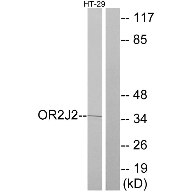 Western Blot - Anti-OR2J2 Antibody (G553) - Antibodies.com