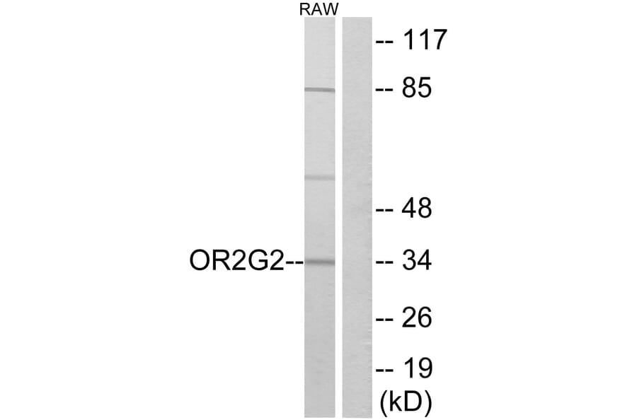 Western Blot - Anti-OR2G2 Antibody (G547) - Antibodies.com