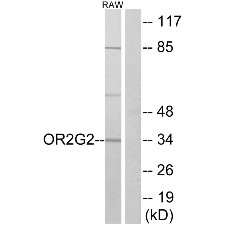 Western Blot - Anti-OR2G2 Antibody (G547) - Antibodies.com