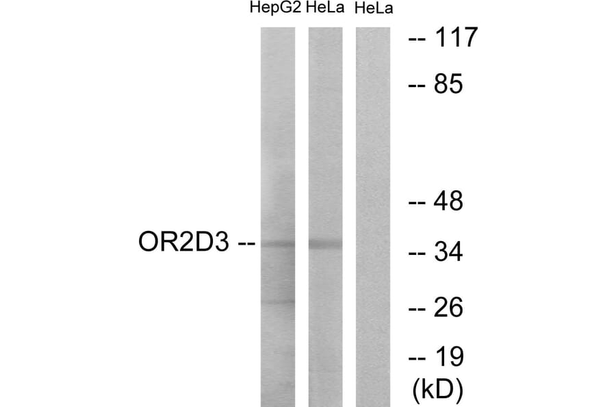 Western Blot - Anti-OR2D3 Antibody (G546) - Antibodies.com