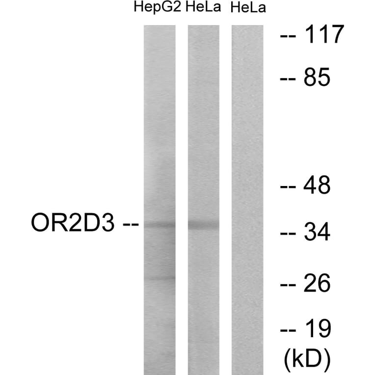 Western Blot - Anti-OR2D3 Antibody (G546) - Antibodies.com