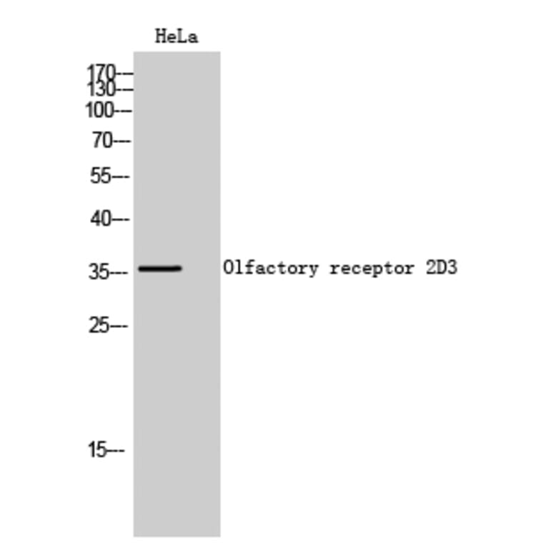 Western Blot - Anti-OR2D3 Antibody (G546) - Antibodies.com