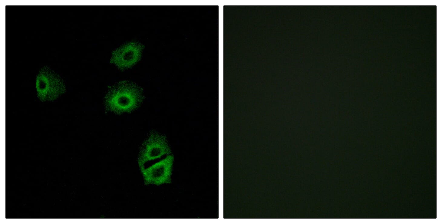 Immunofluorescence analysis of A549 cells using Anti-OR2B2 Antibody. The right hand panel represents a negative control, where the antibody was pre-incubated with the immunising peptide.