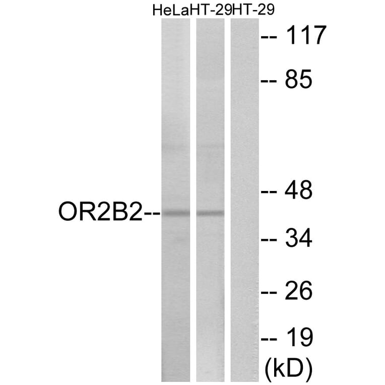 Western Blot - Anti-OR2B2 Antibody (G539) - Antibodies.com