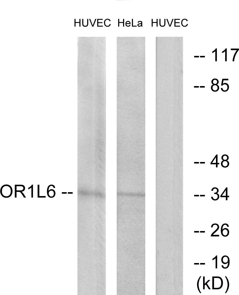 Western blot analysis of lysates from HUVEC and HeLa cells using Anti-OR1L6 Antibody. The right hand lane represents a negative control, where the antibody is blocked by the immunising peptide.