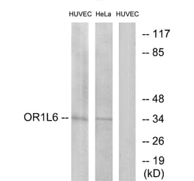 Western Blot - Anti-OR1L6 Antibody (G529) - Antibodies.com