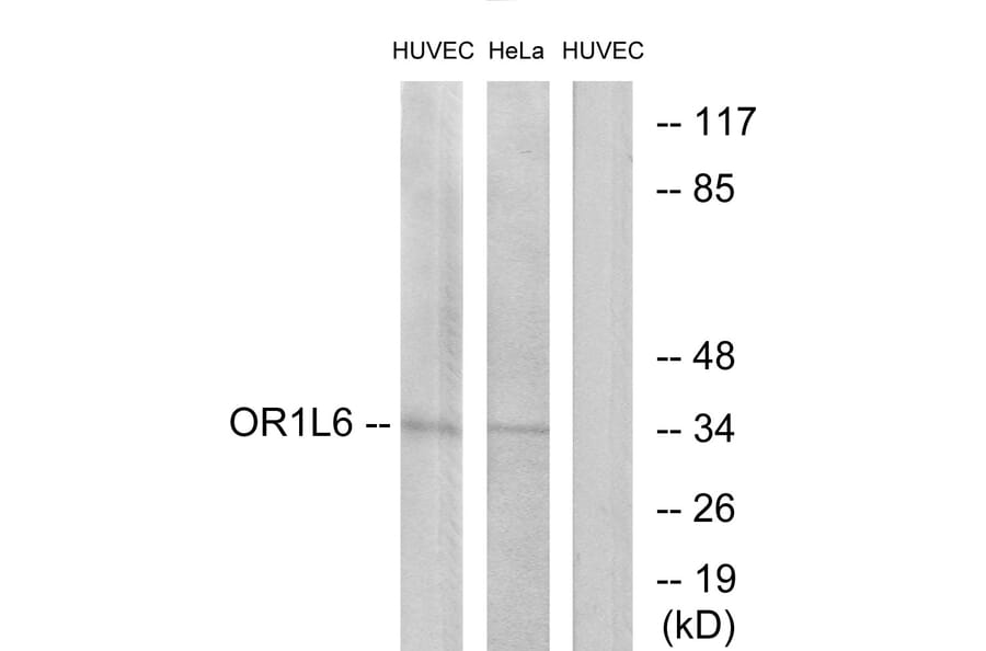 Western Blot - Anti-OR1L6 Antibody (G529) - Antibodies.com