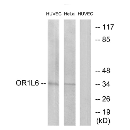 Western Blot - Anti-OR1L6 Antibody (G529) - Antibodies.com