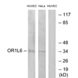 Western Blot - Anti-OR1L6 Antibody (G529) - Antibodies.com