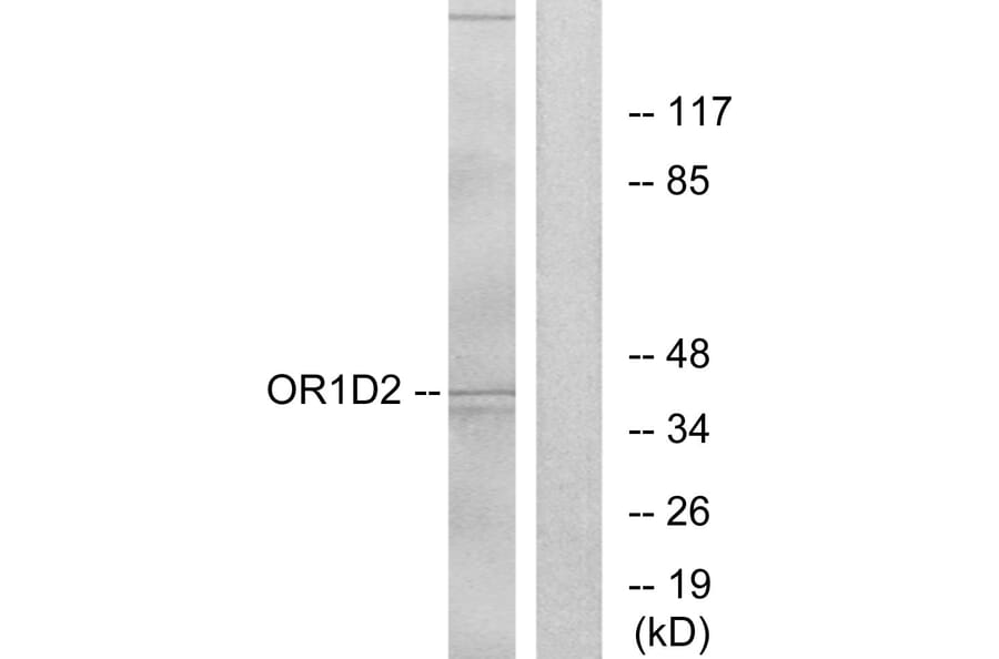 Western Blot - Anti-OR1D2 Antibody (G516) - Antibodies.com