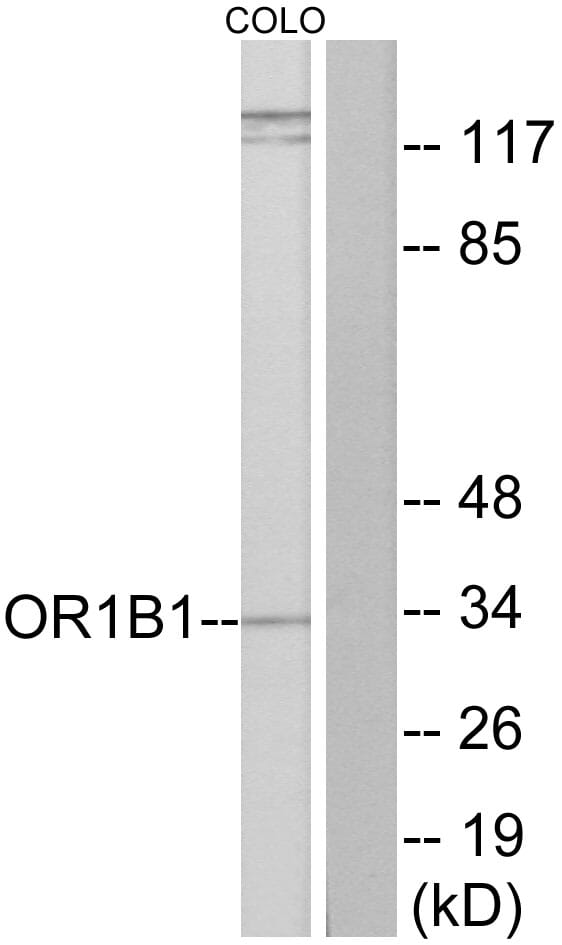 Western blot analysis of lysates from COLO cells using Anti-OR1B1 Antibody. The right hand lane represents a negative control, where the antibody is blocked by the immunising peptide.