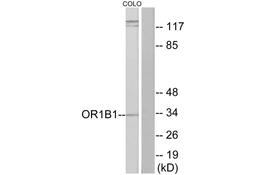 Western Blot - Anti-OR1B1 Antibody (G515) - Antibodies.com