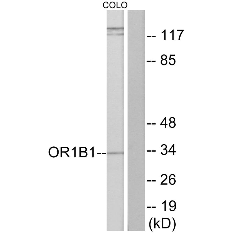 Western Blot - Anti-OR1B1 Antibody (G515) - Antibodies.com