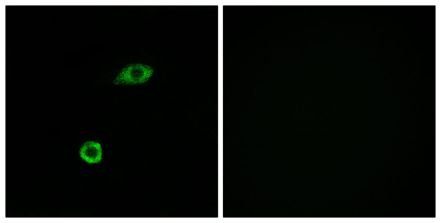 Immunofluorescence analysis of A549 cells using Anti-OR1B1 Antibody. The right hand panel represents a negative control, where the antibody was pre-incubated with the immunising peptide.