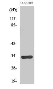 Western blot analysis of various cells using Anti-OR1B1 Antibody.