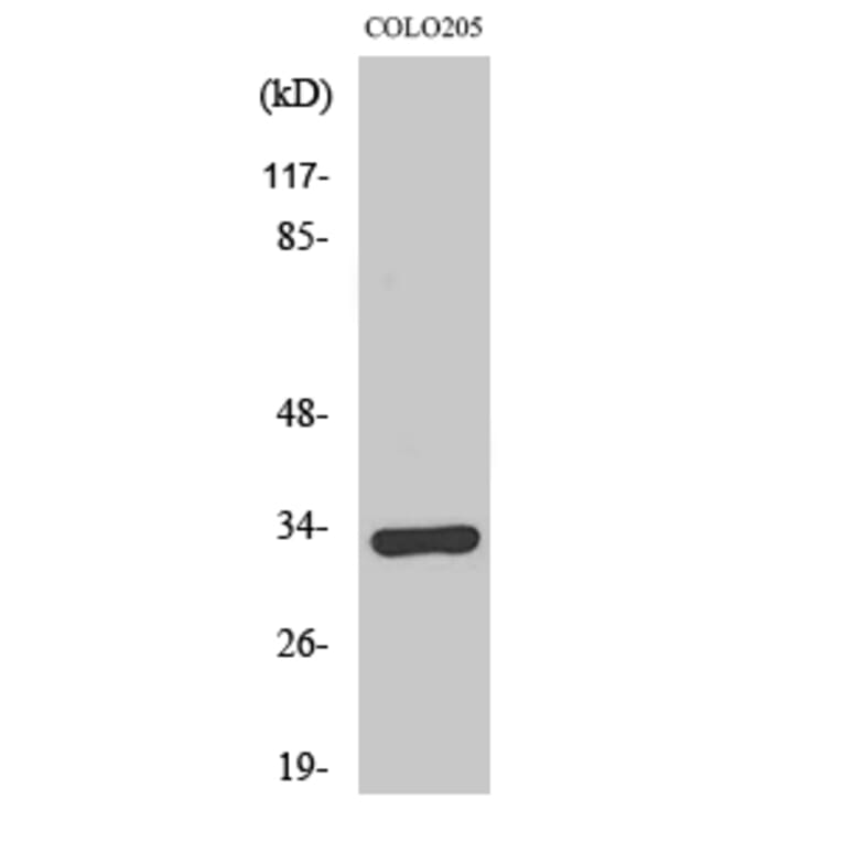 Western Blot - Anti-OR1B1 Antibody (G515) - Antibodies.com