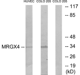 Western Blot - Anti-MRGX4 Antibody (G395) - Antibodies.com