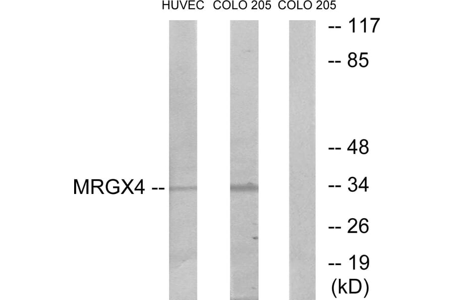 Western Blot - Anti-MRGX4 Antibody (G395) - Antibodies.com