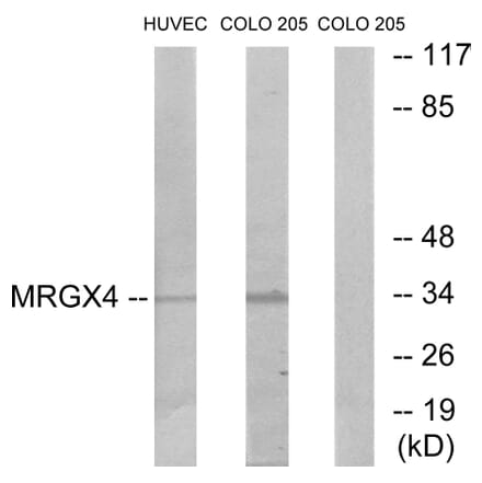 Western Blot - Anti-MRGX4 Antibody (G395) - Antibodies.com