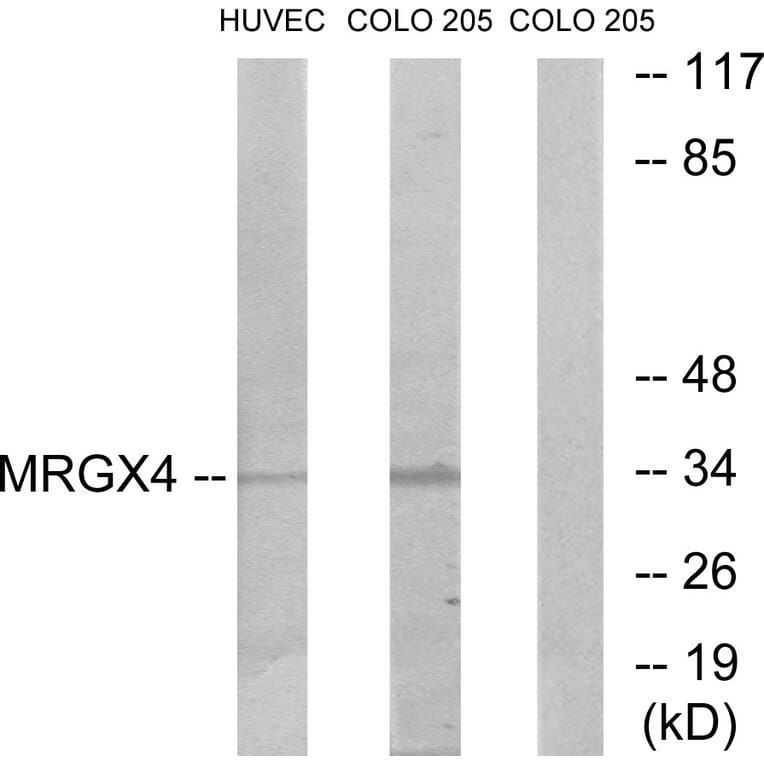 Western Blot - Anti-MRGX4 Antibody (G395) - Antibodies.com