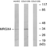 Western Blot - Anti-MRGX4 Antibody (G395) - Antibodies.com