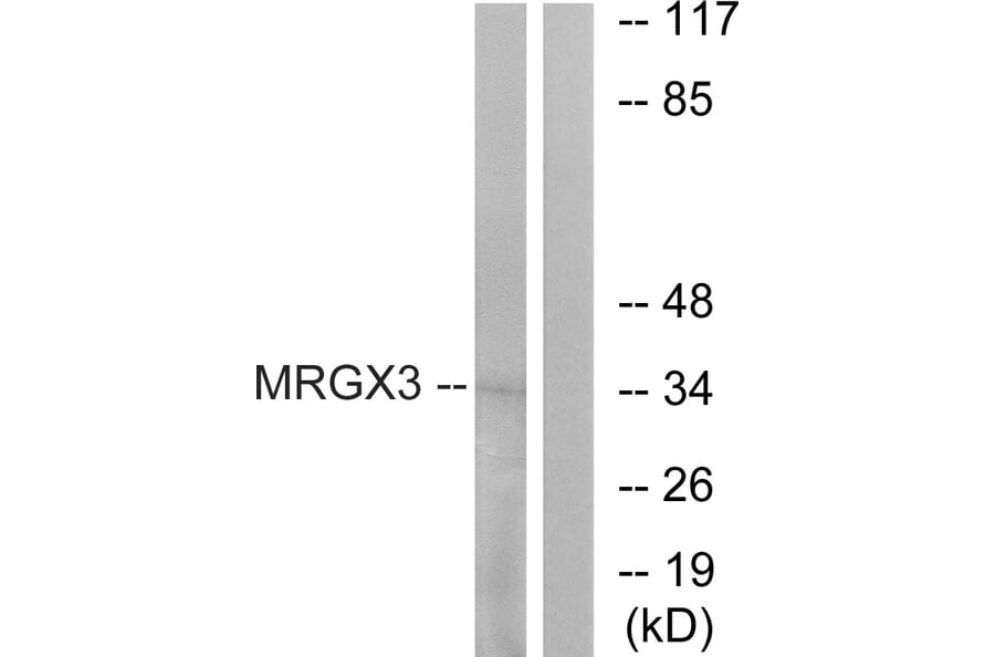 Western Blot - Anti-MRGX3 Antibody (G816) - Antibodies.com