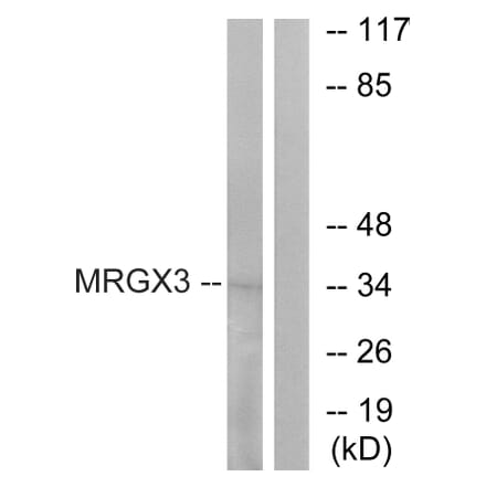 Western Blot - Anti-MRGX3 Antibody (G816) - Antibodies.com