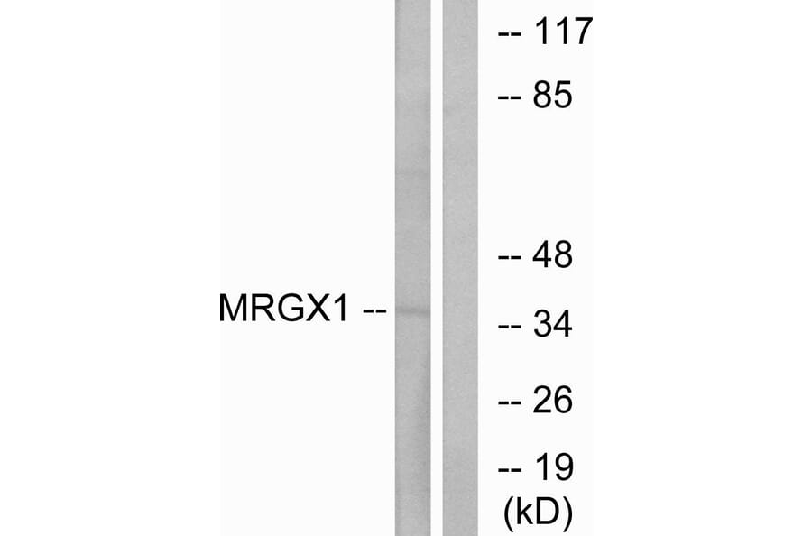 Western Blot - Anti-MRGX1 Antibody (G394) - Antibodies.com