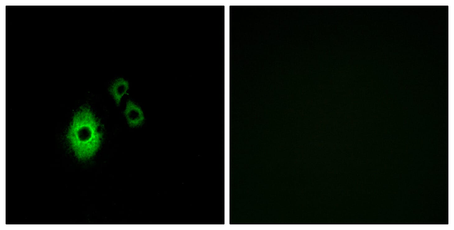 Immunofluorescence analysis of A549 cells using Anti-KCNJ5 Antibody. The right hand panel represents a negative control, where the antibody was pre-incubated with the immunising peptide.